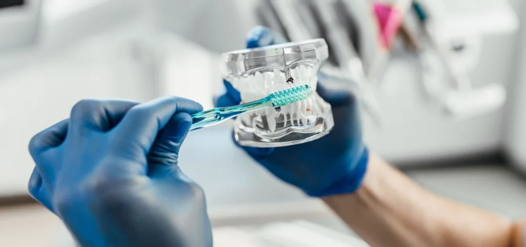 hygiene bucco dentaire endodontiste marseille Hygiène bucco-dentaire Dr Antonietta BORDONE - Endodontiste à Marseille