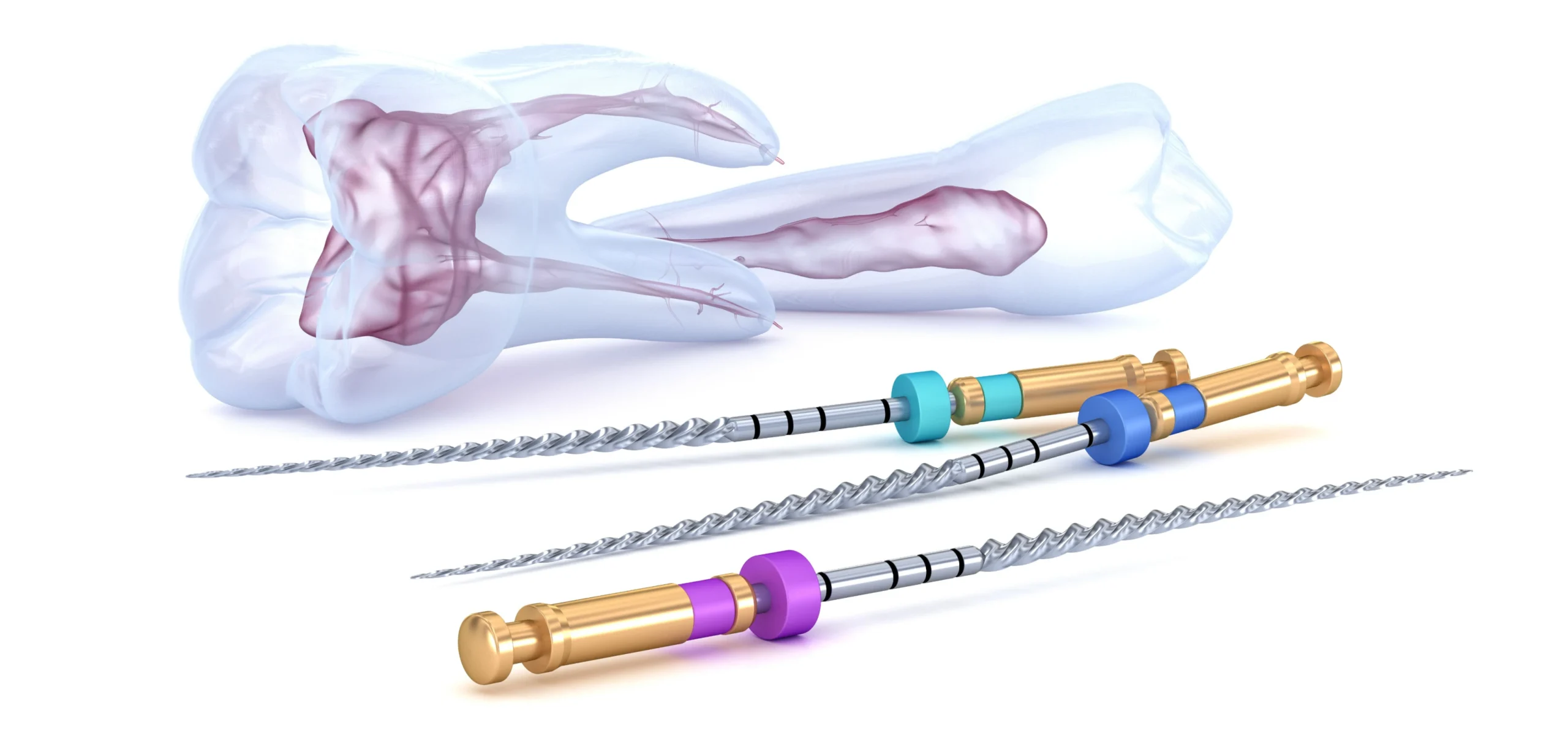 endodontie racine devitalisation marseille scaled Traitement canalaire Dr Antonietta BORDONE - Endodontiste à Marseille