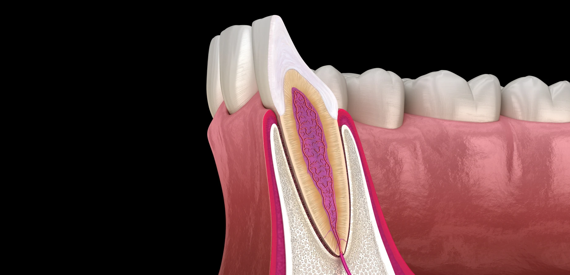 resection apicale endodontiste marseille Résection apicale Dr Antonietta BORDONE - Endodontiste à Marseille