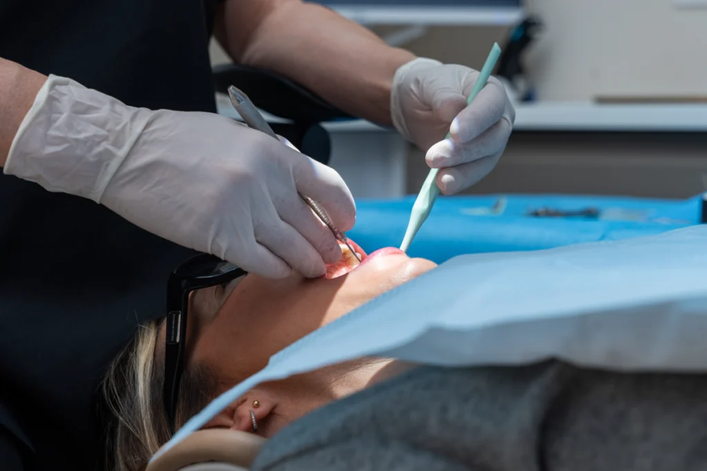 traitement endodontiste marseille dentaire Résection apicale Dr Antonietta BORDONE - Endodontiste à Marseille